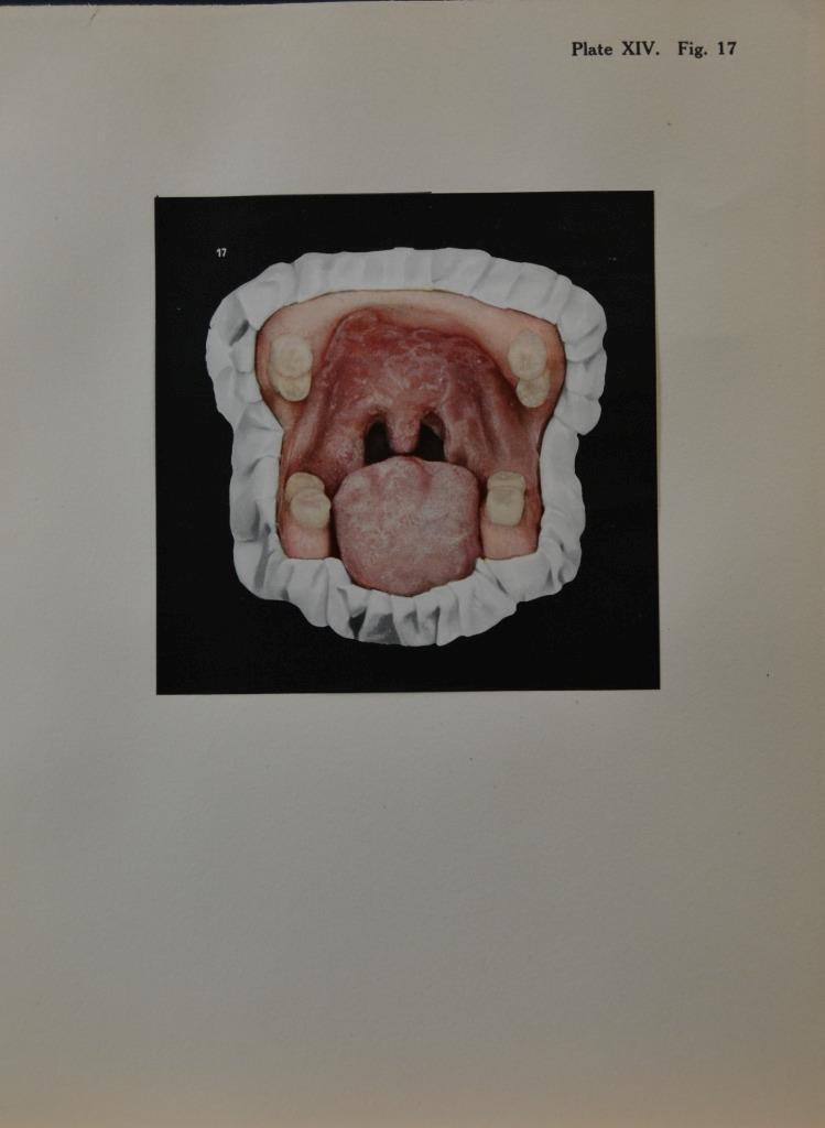 Medical Anatomy Human Face And Mouth Wall Art Halloween Antique Original 1914